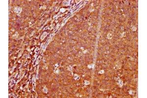 IHC image of ABIN7127705 diluted at 1:100 and staining in paraffin-embedded human tonsil tissue performed on a Leica BondTM system.