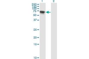 Western Blot analysis of RIOK3 expression in transfected 293T cell line by RIOK3 monoclonal antibody (M01), clone 4A12-1D2.