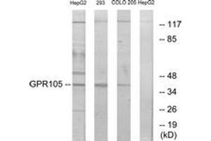 Western blot analysis of extracts from 293/COLO205/HepG2 cells, using GPR105 Antibody. (P2RY14 anticorps  (AA 146-195))