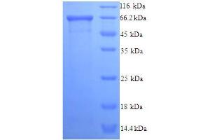 SDS-PAGE (SDS) image for Olfactory Receptor 46 (OLFR46) (AA 1-431), (full length) protein (His-SUMO Tag) (ABIN5709461)