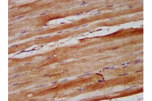 IHC image of ABIN7161101 diluted at 1:600 and staining in paraffin-embedded human skeletal muscle tissue performed on a Leica BondTM system. (Nebulin anticorps  (AA 245-373))