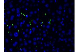 ABIN6267554 at 1/200 staining human gastric tissue sections by ICC/IF. (LIM Domain Kinase 1 anticorps  (pThr508))