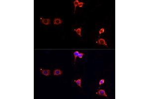 Immunofluorescence analysis of PC12 cells using MTOR antibody.