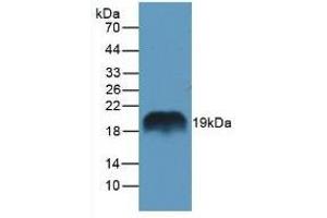 Detection of REG1a in Rat Pancreas Tissue using Polyclonal Antibody to Regenerating Islet Derived Protein 1 Alpha (REG1a) (REG1A anticorps  (AA 10-165))