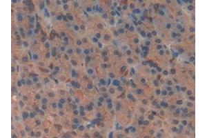 Detection of VIP in Rat Stomach Tissue using Polyclonal Antibody to Vasoactive Intestinal Peptide (VIP)