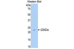 Western Blotting (WB) image for anti-Sulfite Oxidase (SUOX) (AA 89-270) antibody (ABIN1176602) (SUOX anticorps  (AA 89-270))