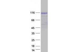 Validation with Western Blot