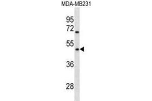 Western Blotting (WB) image for anti-Olfactory Receptor 1Q1 (OR1Q1) antibody (ABIN3000764) (OR1Q1 anticorps)