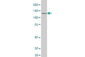 EIF2AK3 polyclonal antibody (A01), Lot # 060525JCS1 Western Blot analysis of EIF2AK3 expression in PC-12