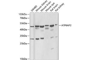 Western blot analysis of extracts of various cell lines, using  antibody (ABIN6129200, ABIN6137342, ABIN6137343 and ABIN6222191) at 1:1000 dilution. (ATP6AP2 anticorps  (AA 251-350))