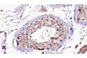 ABIN6275326 at 1/100 staining human testis tissue sections by IHC-P. (NUSAP1 anticorps  (C-Term))