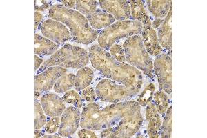 Immunohistochemistry of paraffin-embedded mouse kidney using FKBP6 antibody.