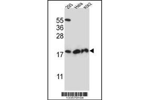 Western blot analysis in 293,Hela,K562 cell line lysates (35ug/lane). (DHFRL1 anticorps  (AA 45-74))