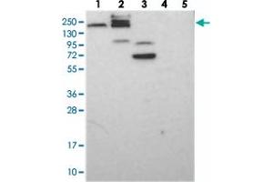 Western blot analysis of Lane 1: RT-4, Lane 2: U-251 MG, Lane 3: Human Plasma, Lane 4: Liver, Lane 5: Tonsil with GEMIN5 polyclonal antibody  at 1:250-1:500 dilution.