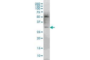 pp9099 monoclonal antibody (M03), clone 3D9 Western Blot analysis of pp9099 expression in Jurkat .