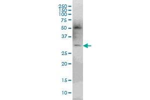 pp9099 monoclonal antibody (M03), clone 3D9 Western Blot analysis of pp9099 expression in Jurkat . (PLEKHO2 anticorps  (AA 392-490))