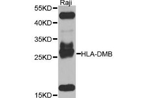 Western blot analysis of extracts of Raji cells, using HLA-DMB antibody. (HLA-DMB anticorps)