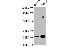 Western Blot Positive WB detected in: HL60 whole cell lysate, Rat brain tissue All lanes: FEV antibody at 5. (FEV anticorps  (AA 1-97))