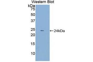 Western Blotting (WB) image for anti-Dynamin 1 (DNM1) (AA 572-745) antibody (ABIN1858658) (Dynamin 1 anticorps  (AA 572-745))