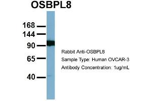 Host:  Rabbit  Target Name:  OSBPL8  Sample Type:  OVCAR-3  Antibody Dilution:  1. (OSBPL8 anticorps  (Middle Region))