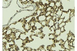 ABIN6268983 at 1/100 staining Mouse lung tissue by IHC-P. (ATRIP anticorps  (pSer224))