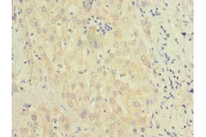 Immunohistochemistry of paraffin-embedded human liver tissue using ABIN7145347 at dilution of 1:100 (BEND7 anticorps  (AA 1-374))