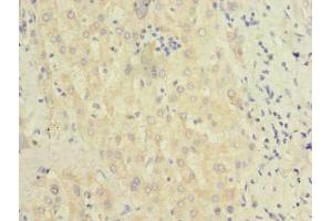 Immunohistochemistry of paraffin-embedded human liver tissue using ABIN7145347 at dilution of 1:100