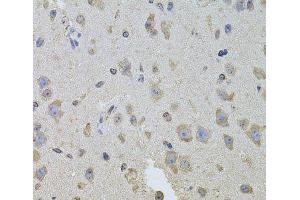 Immunohistochemistry of paraffin-embedded Mouse brain using ITGB8 Polyclonal Antibody at dilution of 1:100 (40x lens). (ITGB8 anticorps)