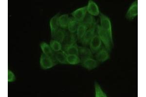 Detection of TUBb in Human MCF7 Cell using Polyclonal Antibody to Tubulin Beta (TUBb)