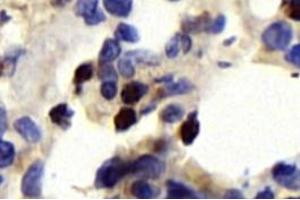 Immunohistochemistry analysis of paraffin-embedded rat lung using,CD63 (ABIN7073400) at dilution of 1: 750 (CD63 anticorps)