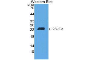 Western Blotting (WB) image for anti-CD6 (CD6) (AA 30-204) antibody (ABIN2118641)