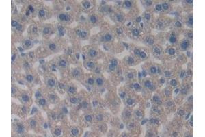 Detection of PDHX in Mouse Liver Tissue using Polyclonal Antibody to Pyruvate Dehydrogenase Complex Component X (PDHX) (PDHX anticorps  (AA 222-471))