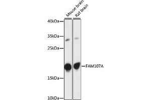 Western blot analysis of extracts of various cell lines, using FA antibody (ABIN7267100) at 1:1000 dilution. (FAM107A anticorps  (AA 1-144))