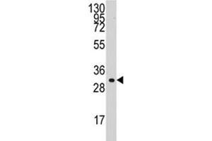 Western blot analysis of Cyclin C antibody and HL-60 lysate. (Cyclin C anticorps  (AA 221-249))