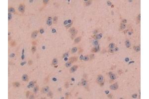 Detection of GAL in Mouse Brain Tissue using Polyclonal Antibody to Galanin (GAL)