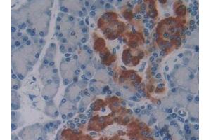 Detection of OPN in Rat Pancreas Tissue using Polyclonal Antibody to Osteopontin (OPN)