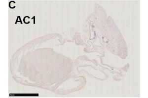 Immunohistochemistry of a left-sided rat heart for adenylyl cyclase AC1 (moderately positive) Source: PMID35625651