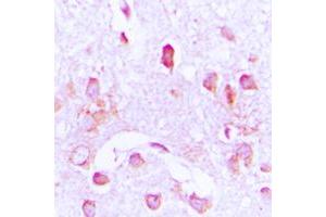 Immunohistochemical analysis of CDC37 staining in human brain formalin fixed paraffin embedded tissue section. (CDC37 anticorps  (Center))