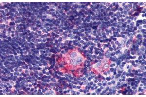 Anti-LPAR6 / P2RY5 antibody  ABIN1049020 IHC staining of human thymus. (LPAR6 anticorps  (Extracellular Domain))