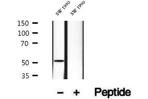 Western blot analysis of extracts of SW 1990 cells, using HERP antibody. (HERPUD1 anticorps  (N-Term))