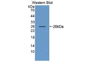 Western blot analysis of the recombinant protein. (Ninein anticorps  (AA 1-153))