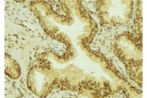 ABIN6277632 at 1/100 staining Mouse colon tissue by IHC-P. (UGT1A4 anticorps)