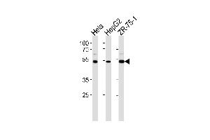 Western blot analysis in Hela,HepG2,ZR-75-1 cell line lysates (35ug/lane). (RAP1 anticorps  (C-Term))