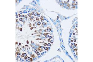 Immunohistochemistry of paraffin-embedded mouse testis using YB-1/YB-1/YBX1 antibody (ABIN6134494, ABIN6150328, ABIN6150330 and ABIN7101815) at dilution of 1:100 (40x lens). (YBX1 anticorps  (AA 100-200))