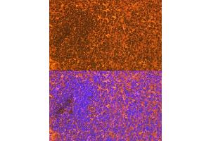 Immunofluorescence analysis of mouse spleen using CD83 Rabbit mAb (ABIN7266223) at dilution of 1:100 (40x lens). (CD83 anticorps)