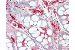 Anti-LAMP1 / CD107a antibody IHC staining of human colon.