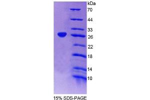SDS-PAGE analysis of Human SSA1 Protein. (TRIM21 Protéine)
