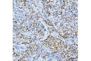 IHC analysis of AGR2 using anti-AGR2 antibody (ABIN5518726). (AGR2 anticorps  (AA 21-175))