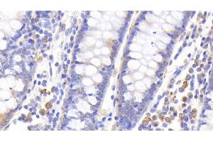 Detection of MT1 in Human Colon Tissue using Polyclonal Antibody to Metallothionein 1 (MT1) (MT1 anticorps  (AA 1-61))