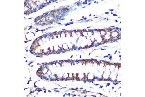 Immunohistochemistry of paraffin-embedded human colon using Aromatase (CYP19) Rabbit mAb (2238) at dilution of 1:100 (40x lens).